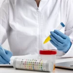 Diagnostico de proteina en la orina