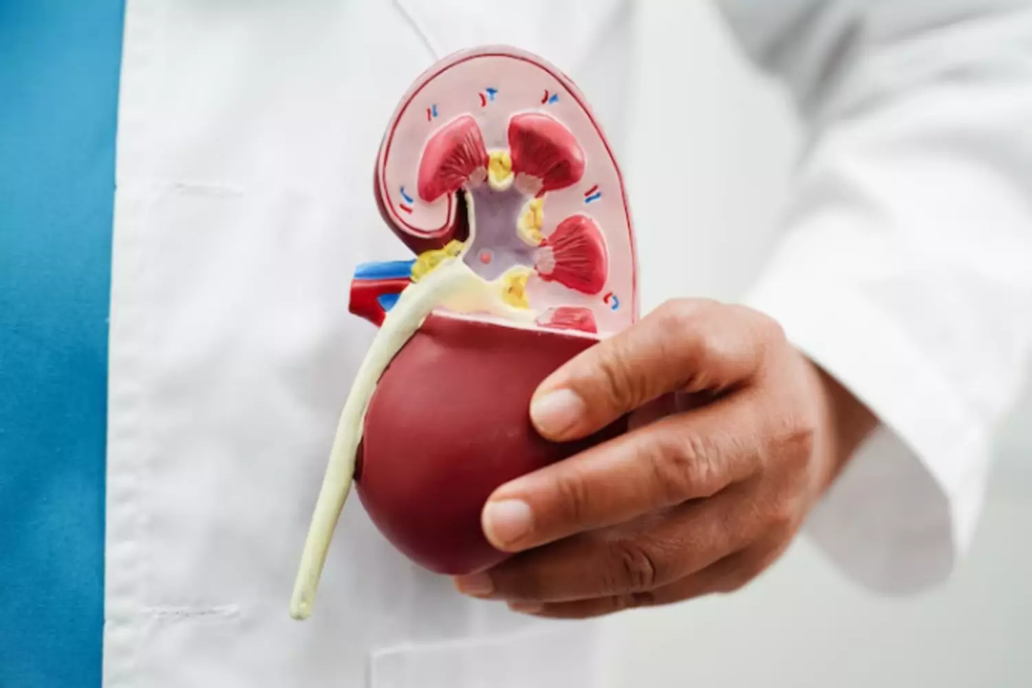Como afecta a los riñones el sindrome de goodpasture