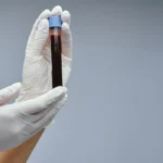 analisis de sangre