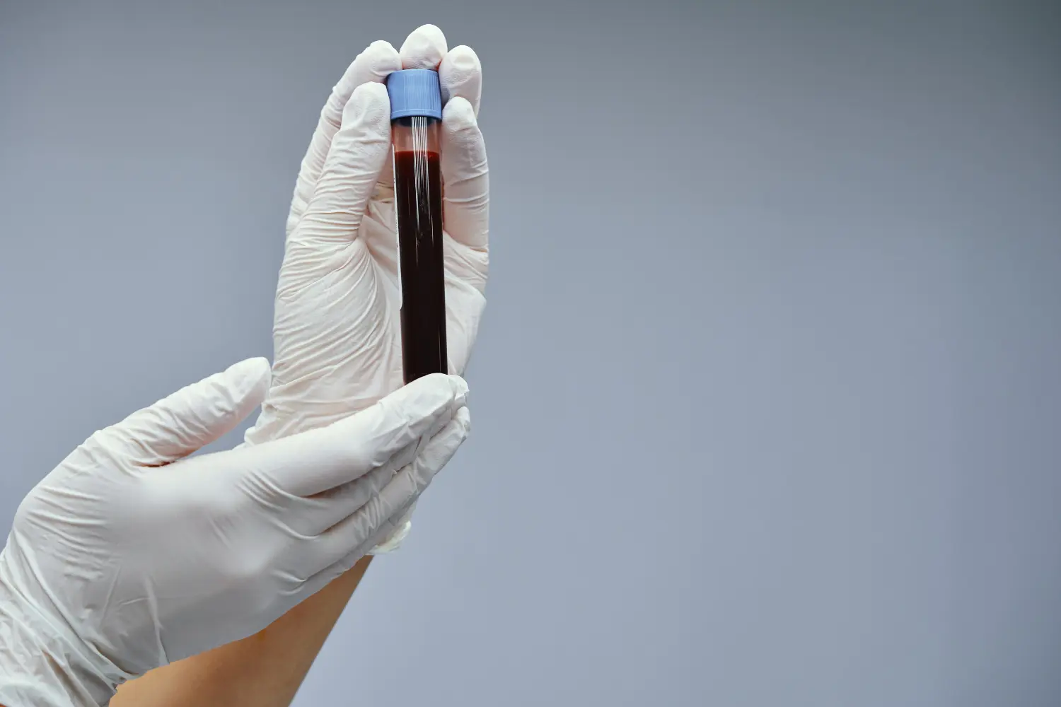 analisis de sangre