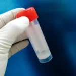 azoospermia
