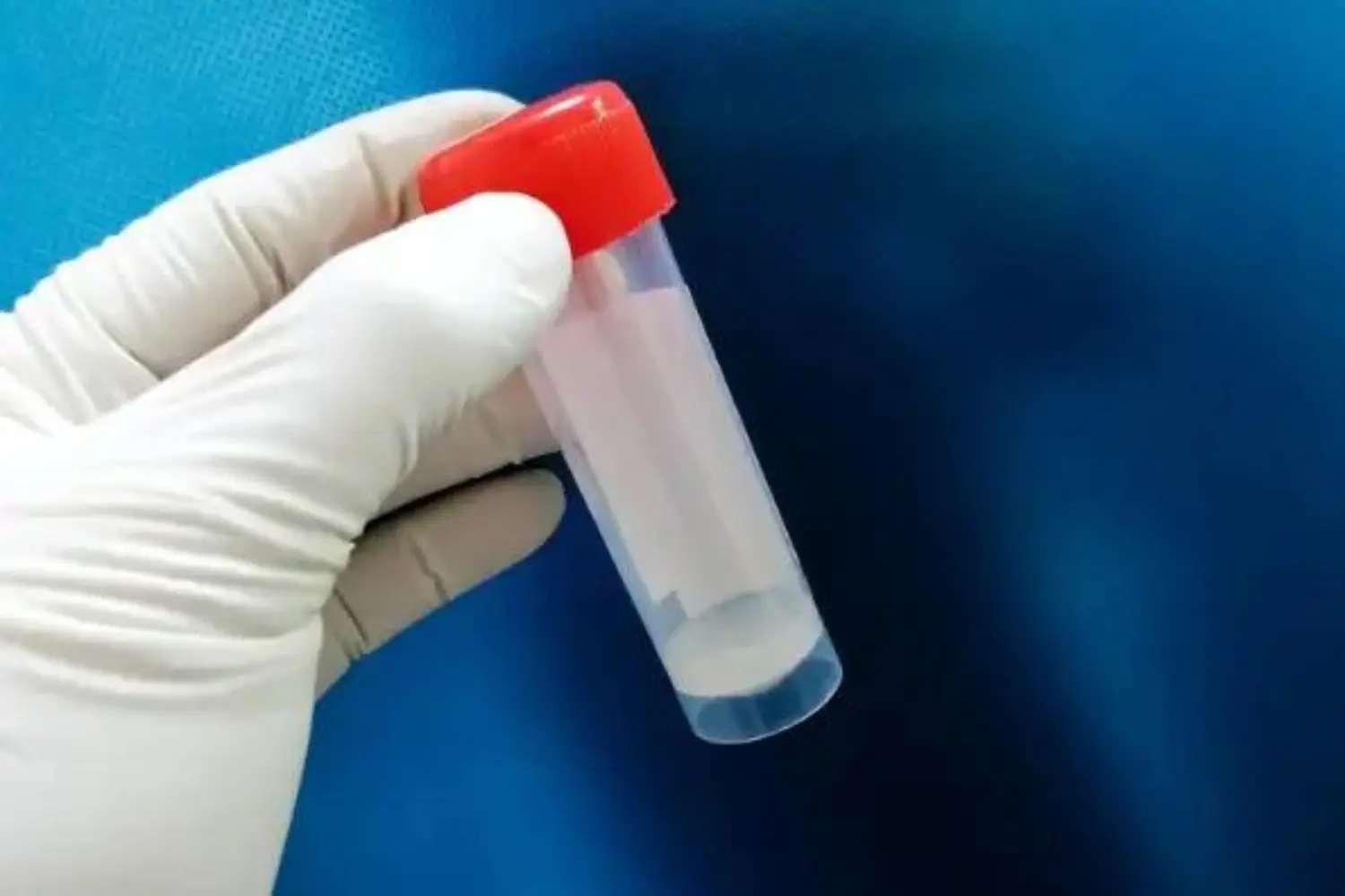 azoospermia