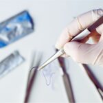 La vasectomia se puede revertir
