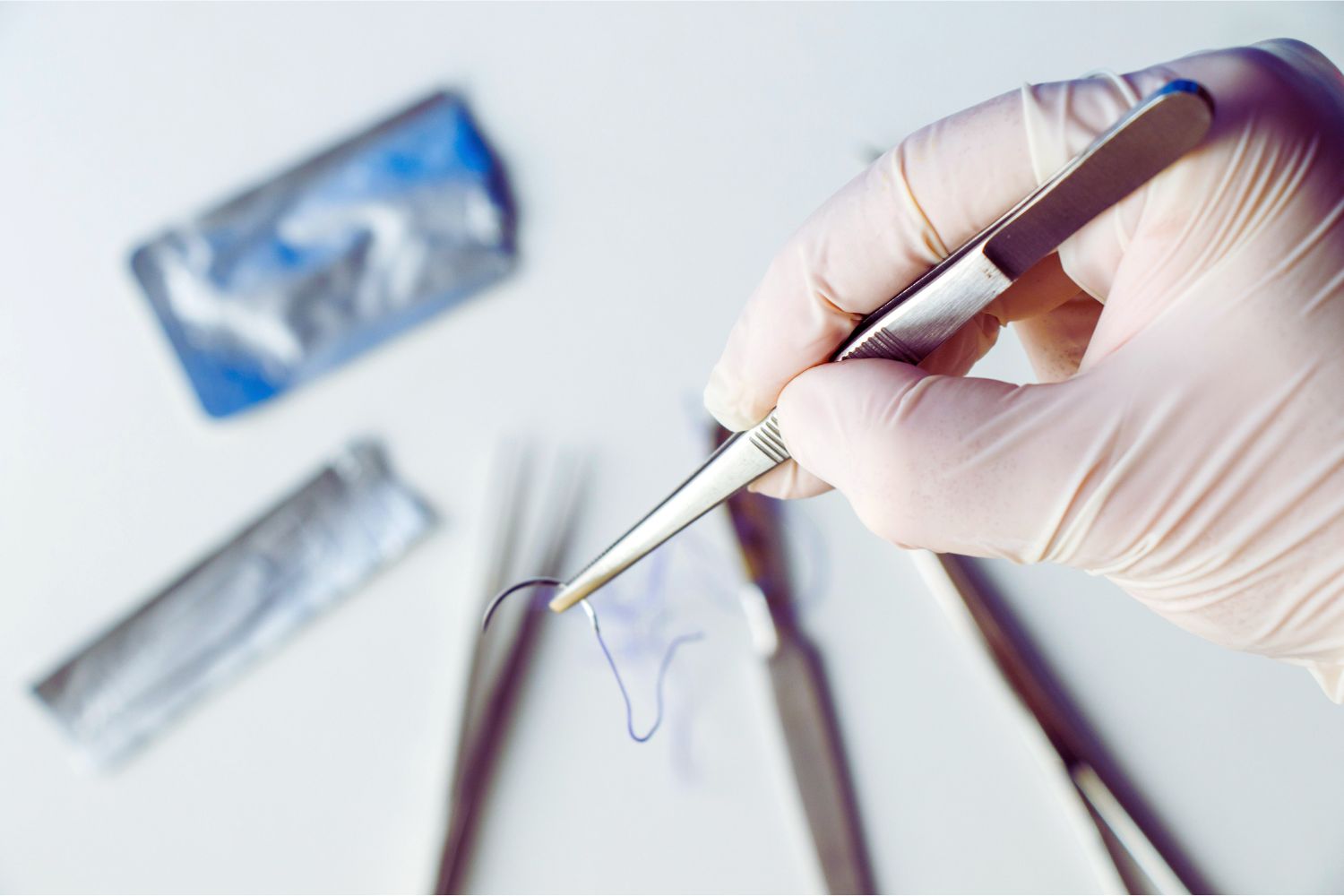 La vasectomia se puede revertir