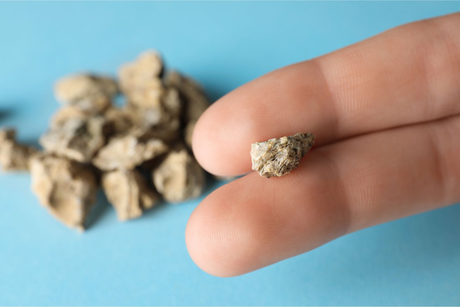 por qué salen piedras en los riñones