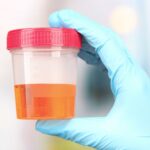 sangre en la orina en mujeres