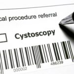cistoscopia