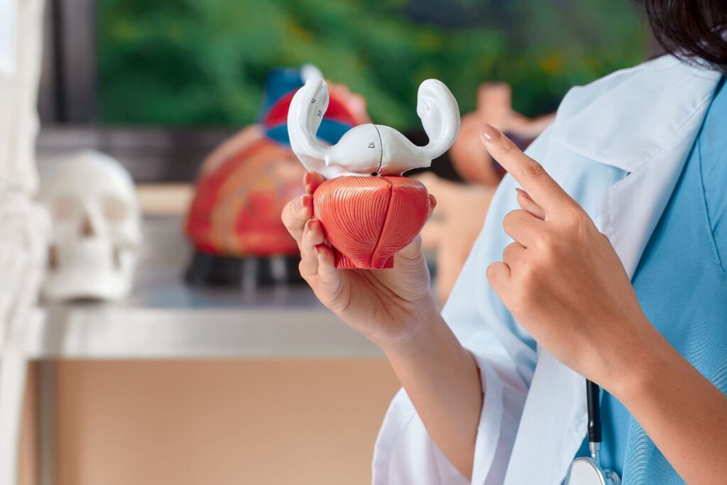 Cistectomía Radical