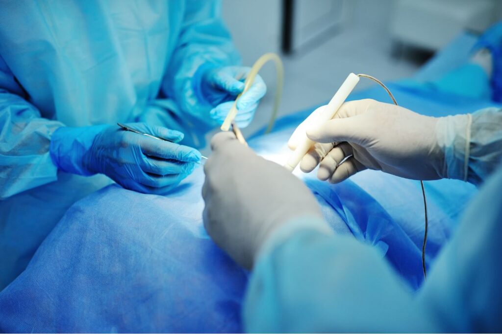 Frenuloplastia