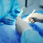 Frenuloplastia