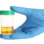 Urocultivo con Antibiograma