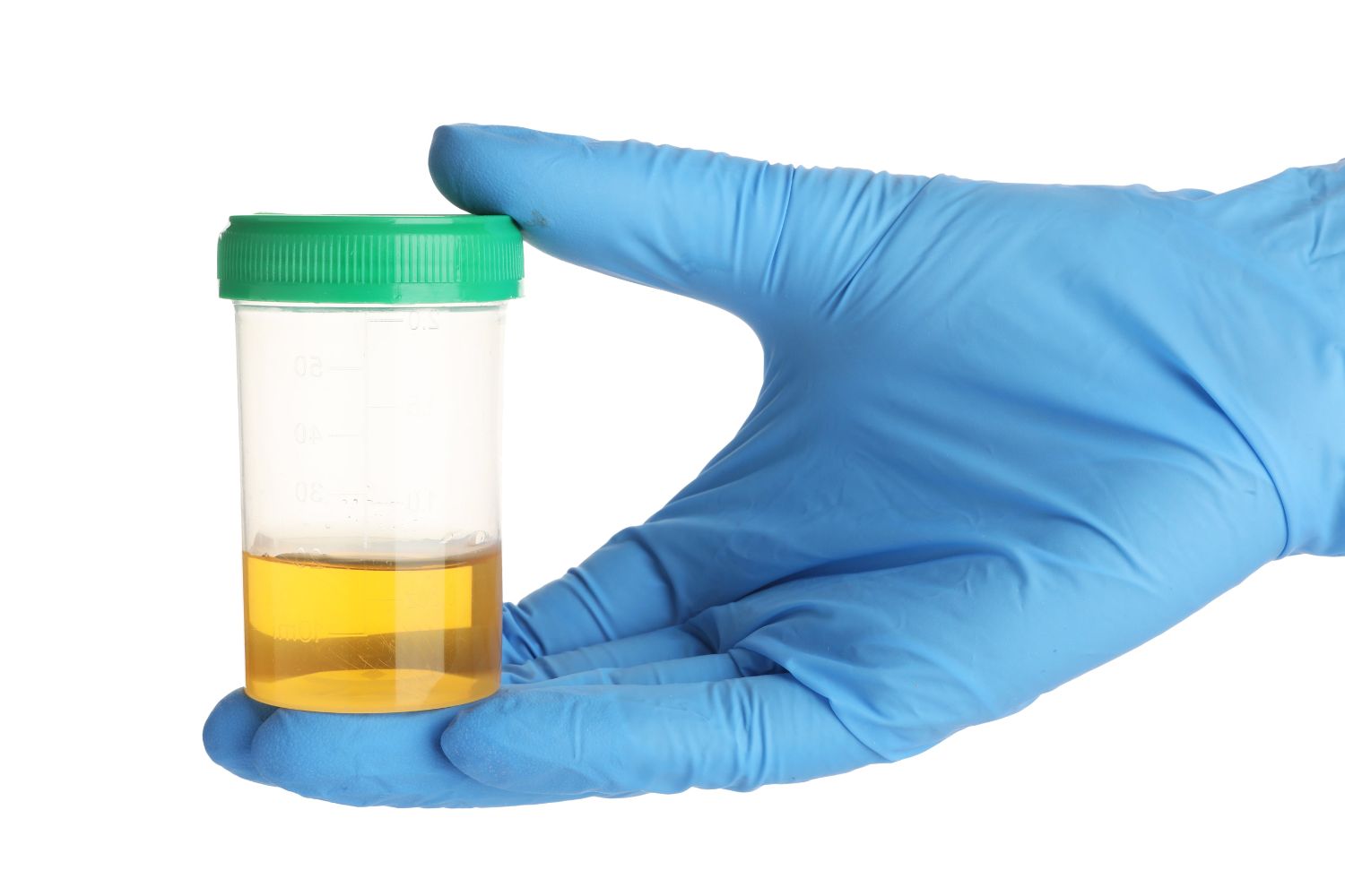 Urocultivo con Antibiograma