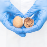 Orquitis testicular