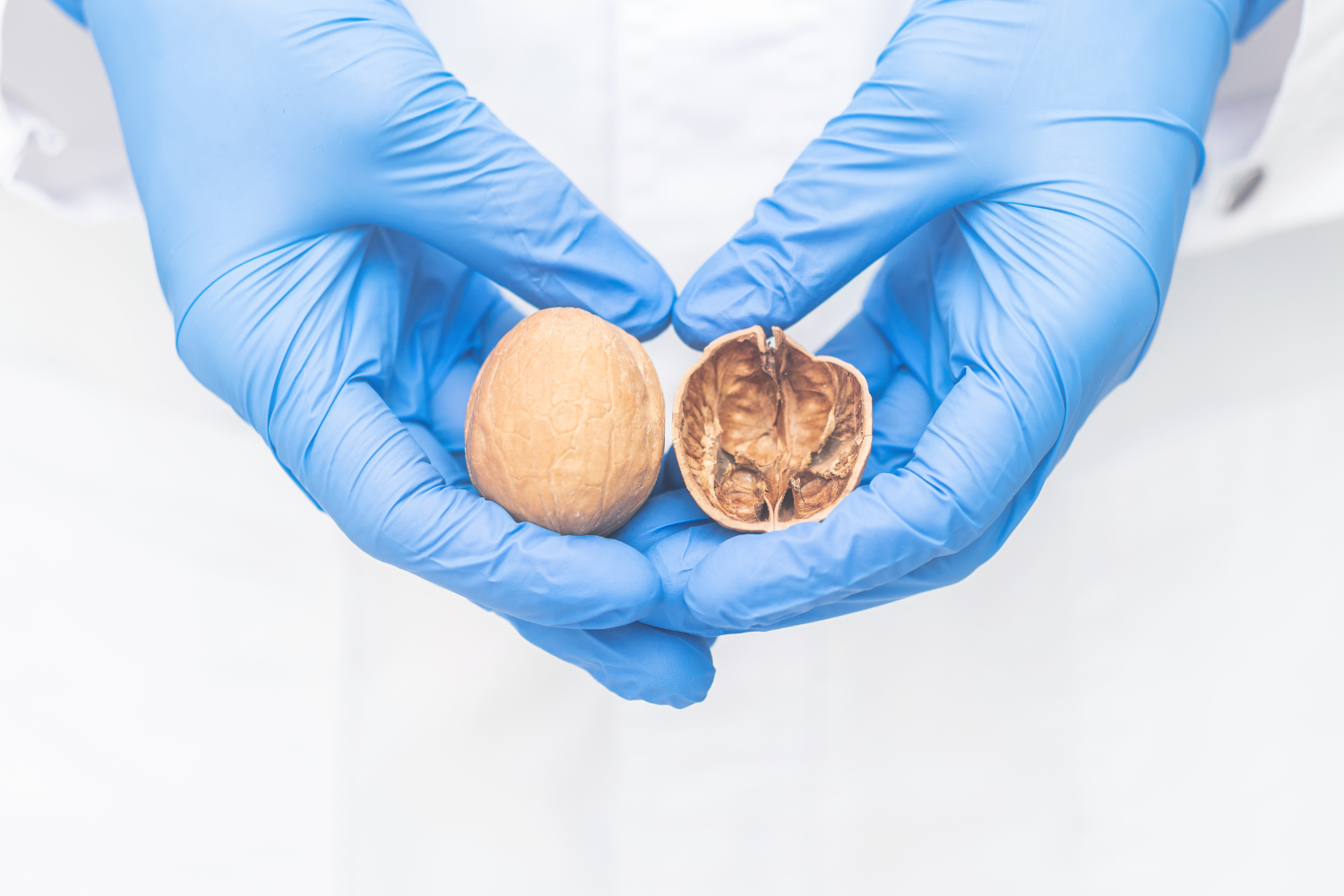 Orquitis testicular